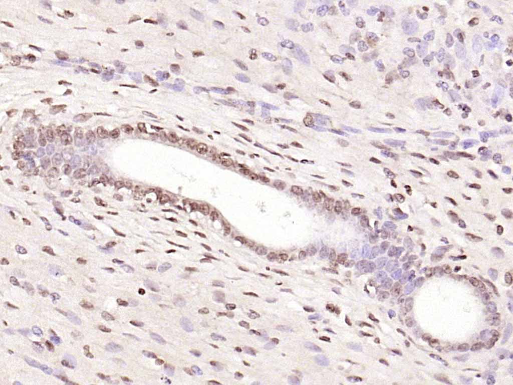 NFKB1 Rabbit pAb(bs-1194R)-50u