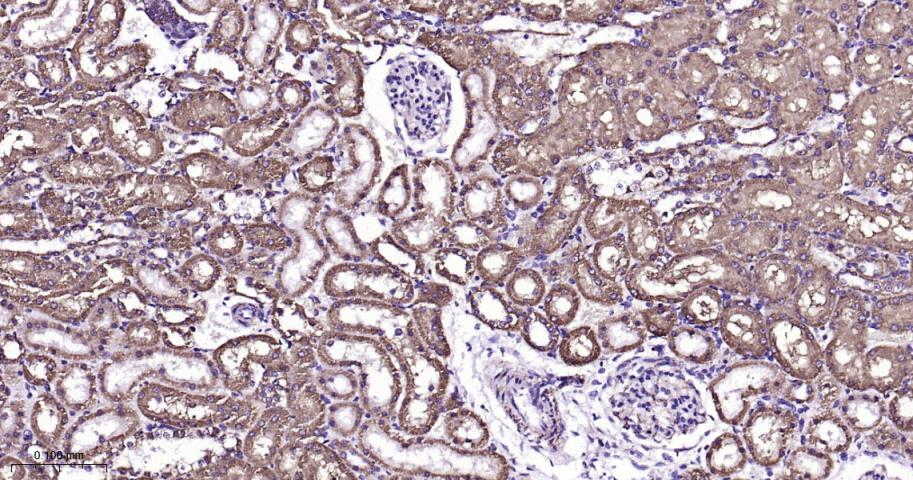 VDAC1 Recombinant Rabbit mAb, 