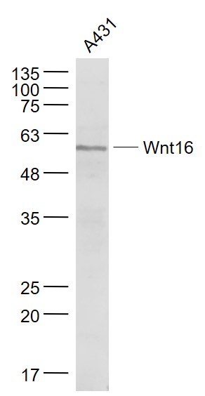 Wnt16 Rabbit pAb(bs-9476R)-50u