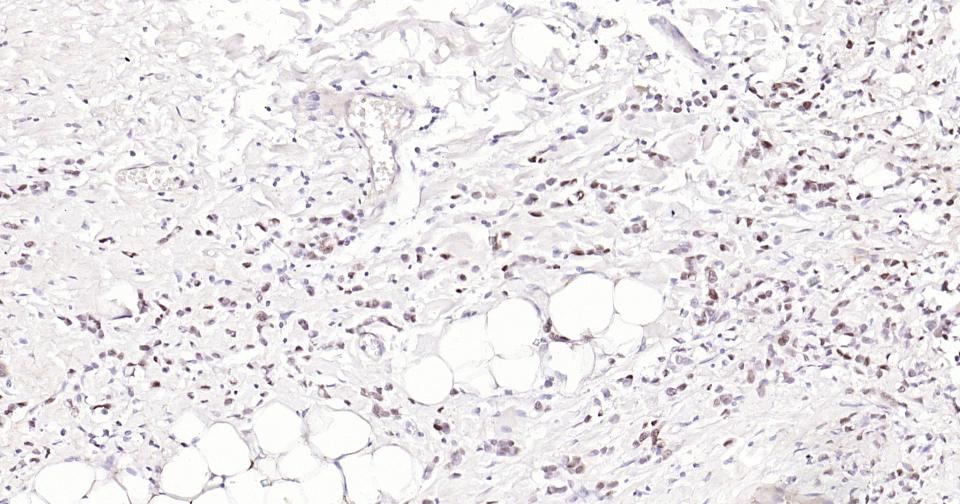 PCNA Rabbit pAb(bs-10889R)-50u