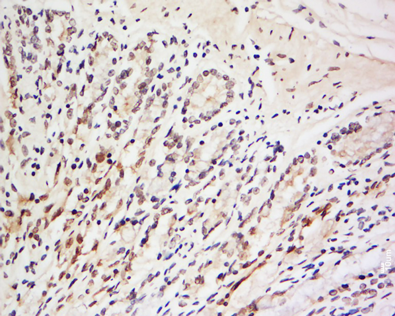 LRRC39 Rabbit pAb(bs-12312R)-5