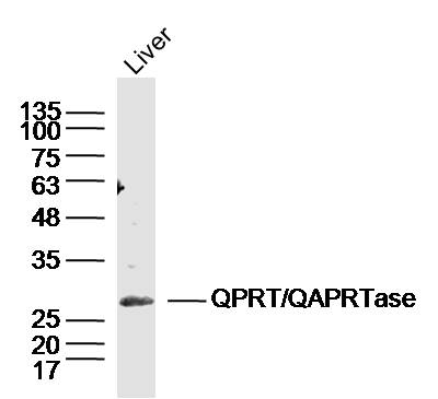 QPRT/QAPRTase Rabbit pAb(bs-20