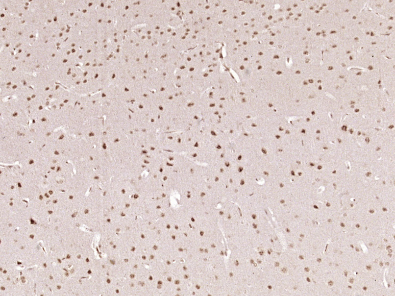 phospho-AMPK alpha 1 (Thr183) 