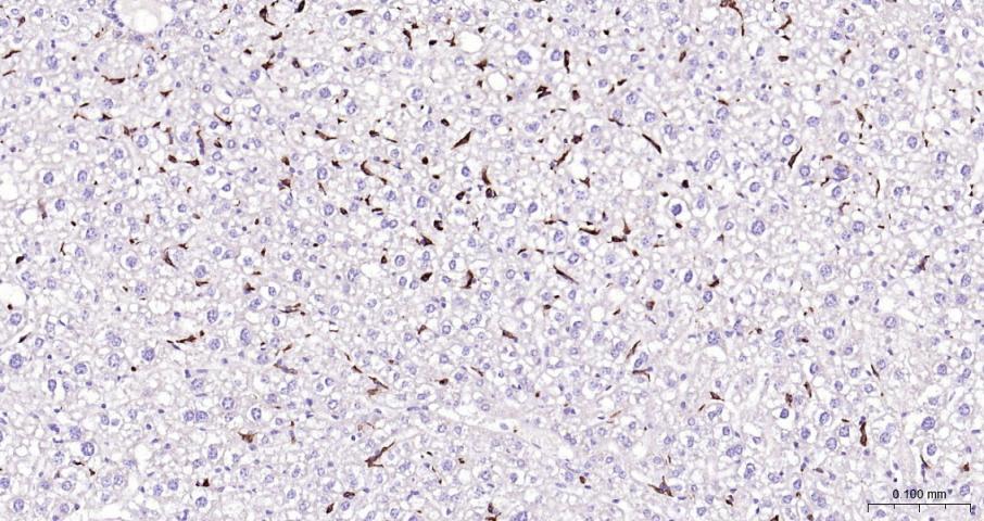 CD163 Rabbit pAb(bs-2527R)-50u