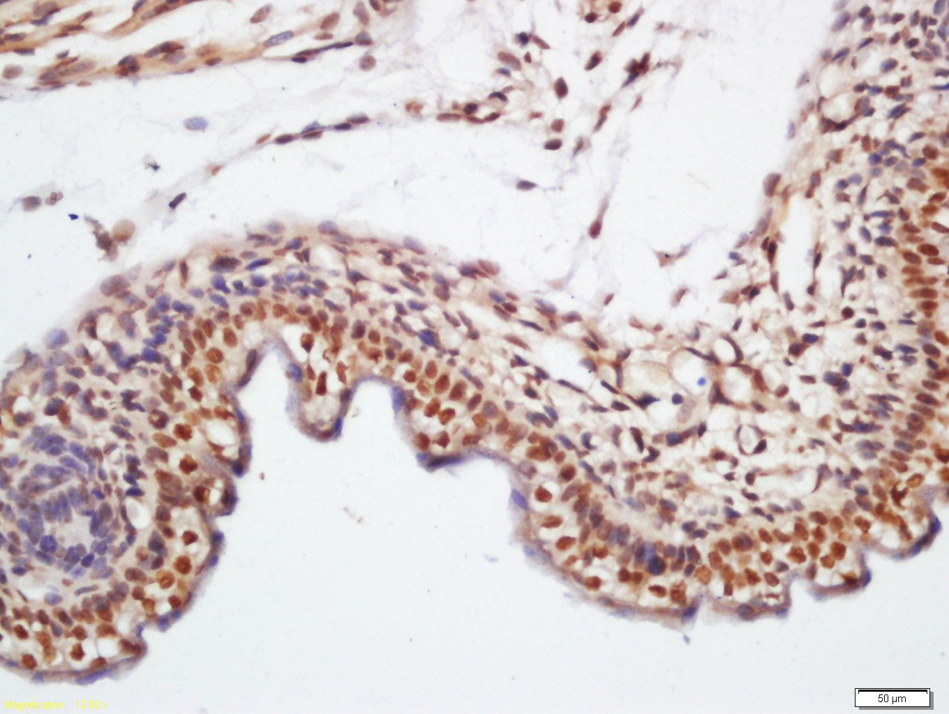 KLHL7 Rabbit pAb(bs-5935R)-50u