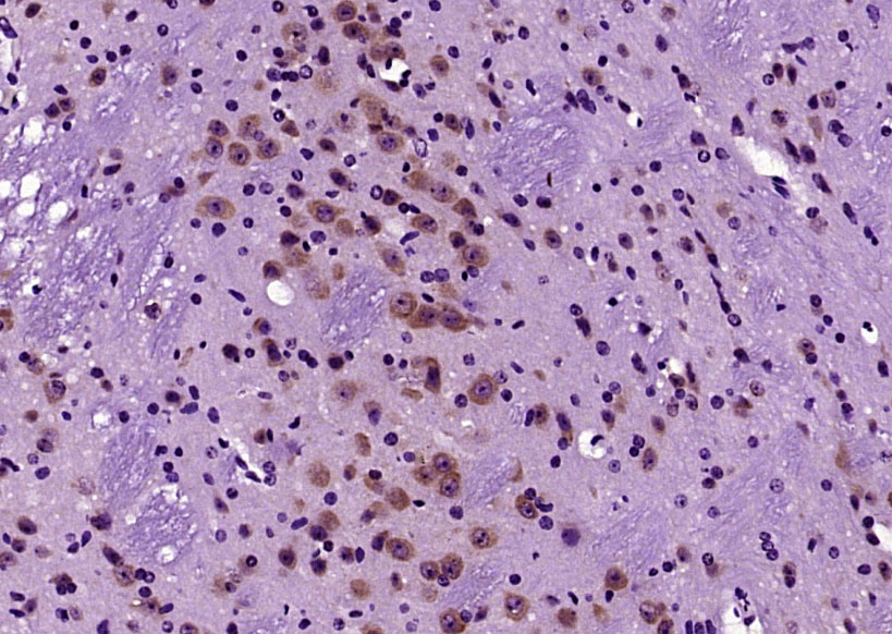 ErbB4 Rabbit pAb(bs-10226R)-50