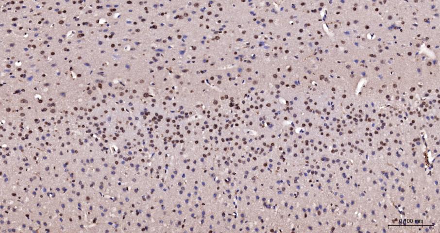 Histone H3(di methyl K27) Mous