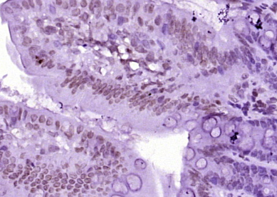 Histone H3 (mono methyl K9) Mo