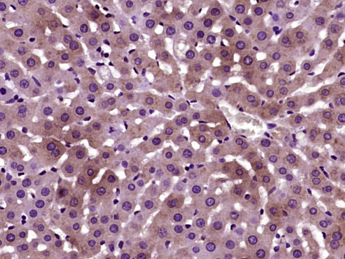 PANK3 Rabbit pAb(bs-8339R)-50u