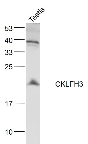 CKLFH3 Rabbit pAb(bs-8021R)-50