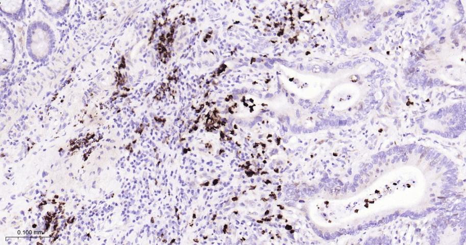 TYMS Recombinant Rabbit mAb(bs