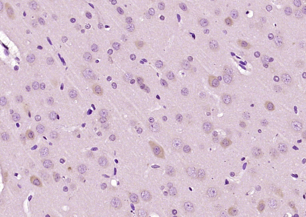 STIP1 Rabbit pAb(bs-9600R)-50u