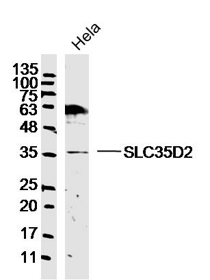 SLC35D2 Rabbit pAb(bs-19824R)-