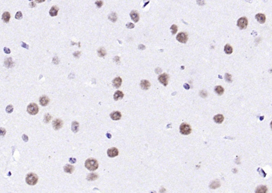 KLHL7 Rabbit pAb(bs-5935R)-50u