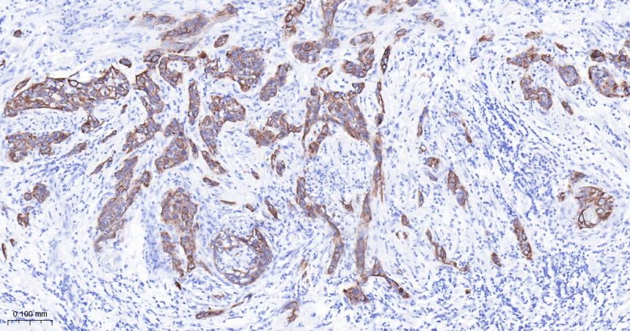 Cytokeratin 17 Recombinant Rab