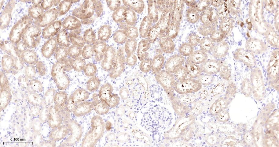 GBA Recombinant Rabbit mAb(bsm