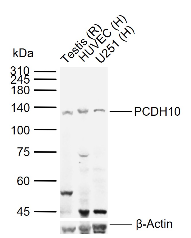 PCDH10 Rabbit pAb(bs-13723R)-5