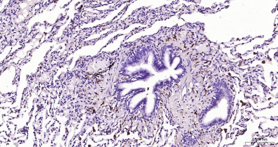 CD163 Rabbit pAb(bs-2527R)-50u