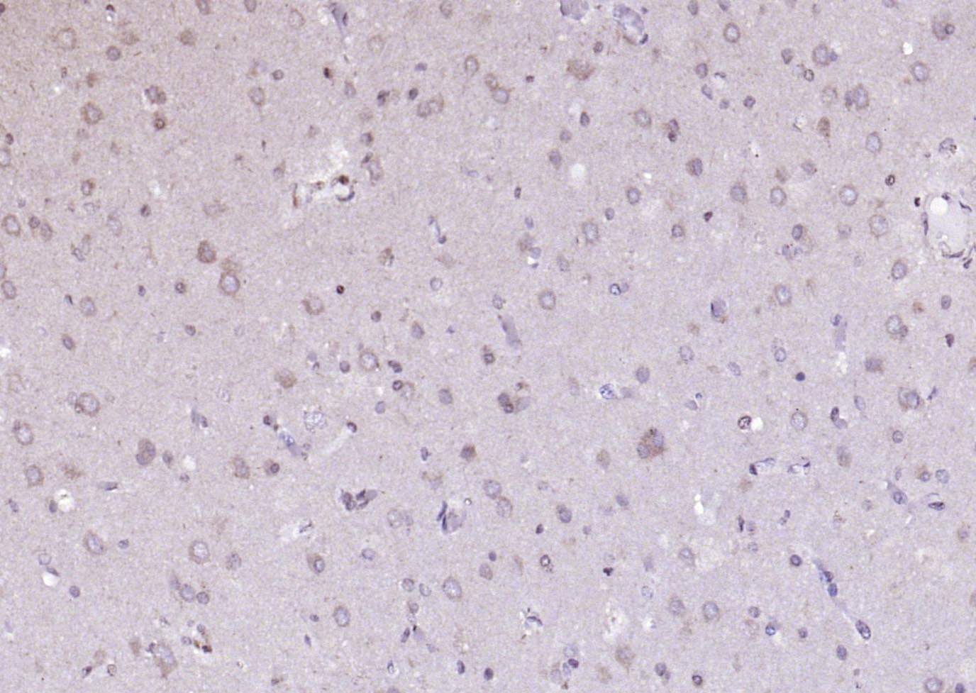 ANKRD54 Rabbit pAb(bs-20549R)-