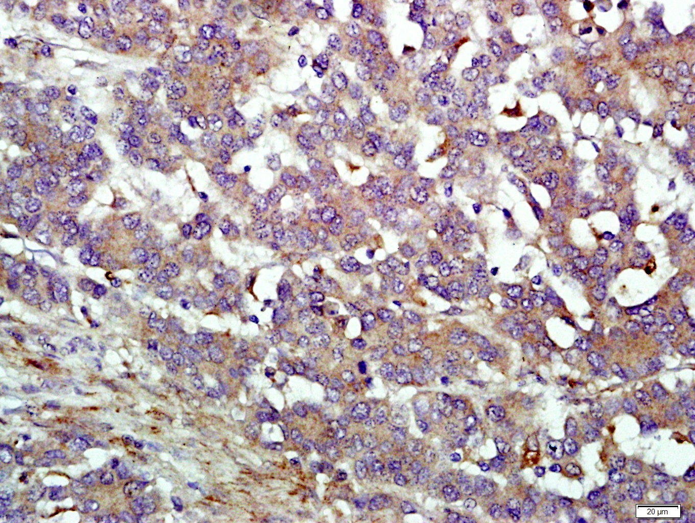 IFIT1B Rabbit pAb(bs-15554R)-5