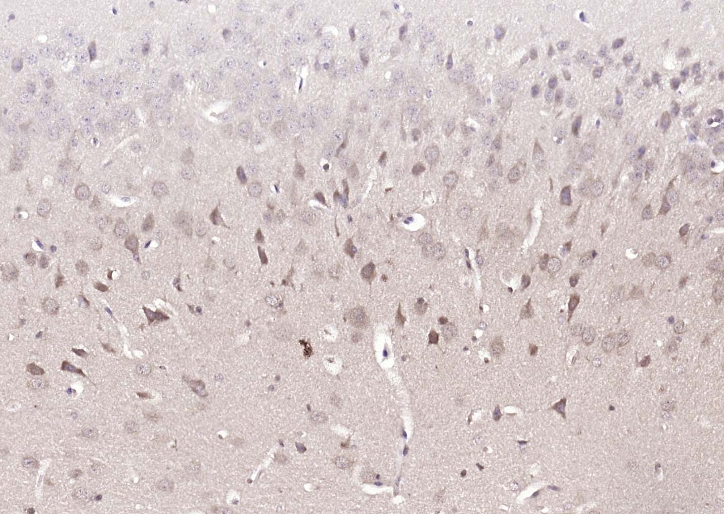 DUSP10 Rabbit pAb(bs-13035R)-5