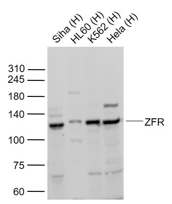 ZFR Rabbit pAb(bs-19137R)-50ul
