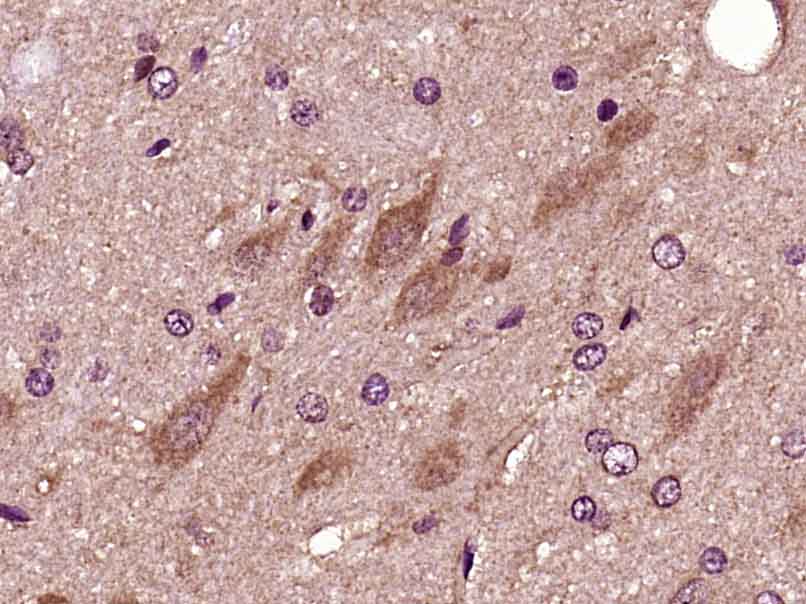 phospho-PFKFB3/PFK2 (Ser467) R