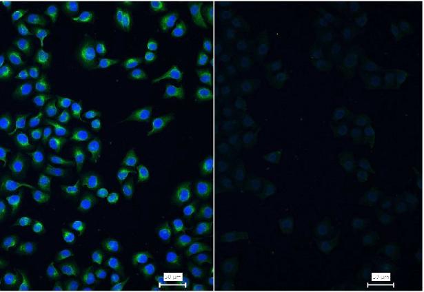 Vimentin Mouse mAb(bsm-33170M)