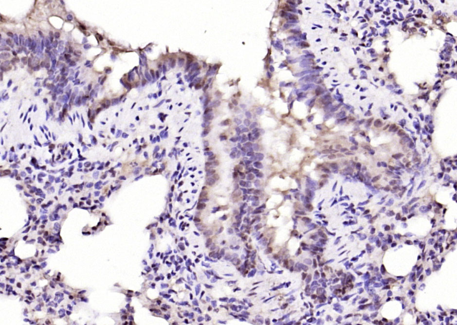 NFATC4 Rabbit pAb(bs-6461R)-50