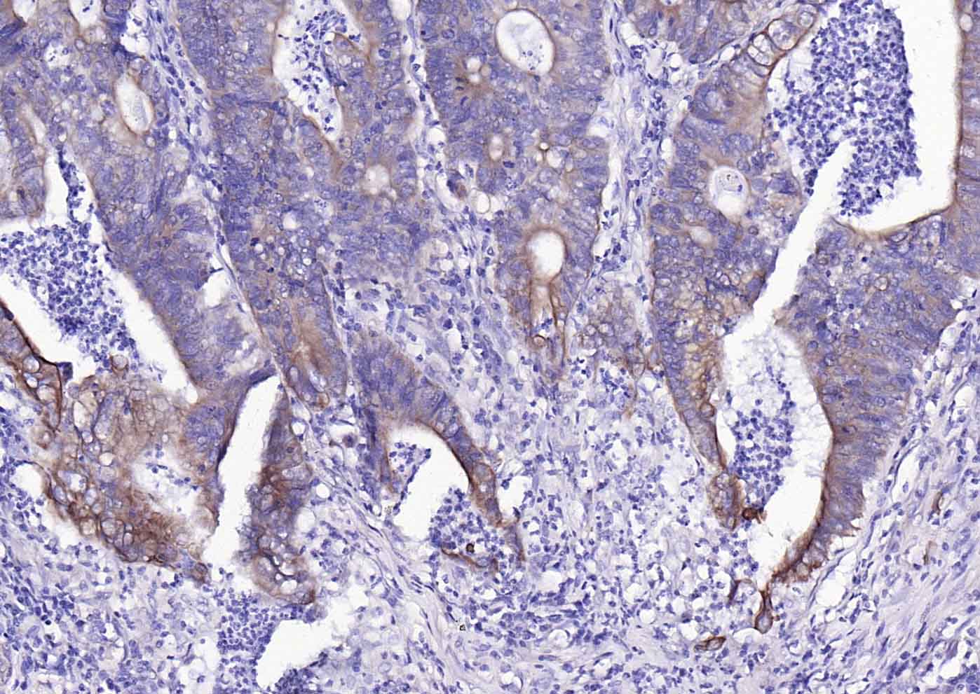 ACVRL1 Rabbit pAb(bs-6020R)-50