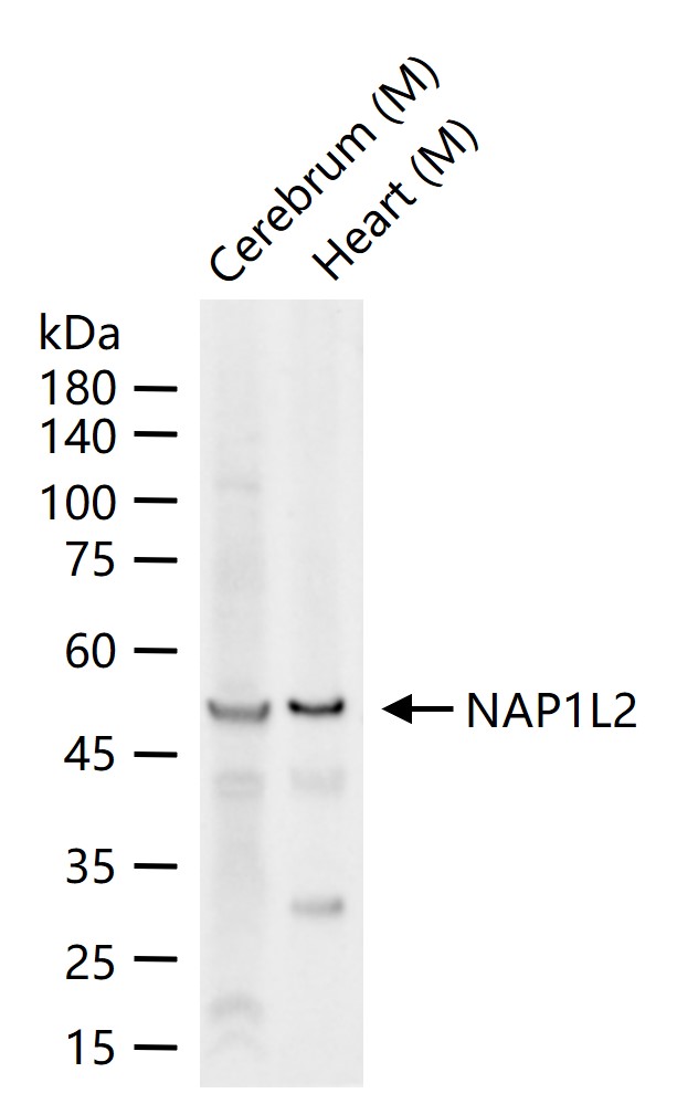 NAP1L2 Rabbit pAb(bs-11172R)-5