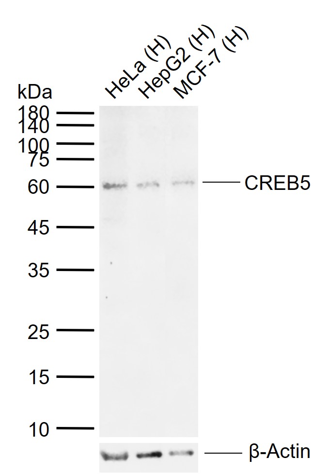 CREB5 Rabbit pAb(bs-14053R)-50