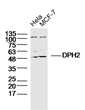 DPH2 Rabbit pAb(bs-8282R)-50ul