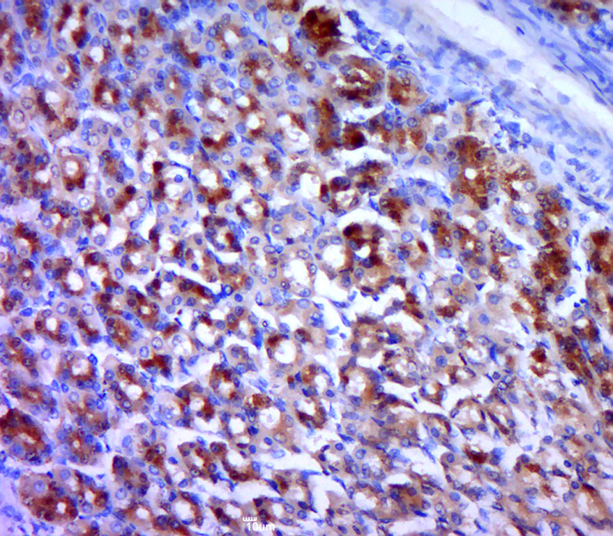 GAK Rabbit pAb(bs-16212R)-50ul