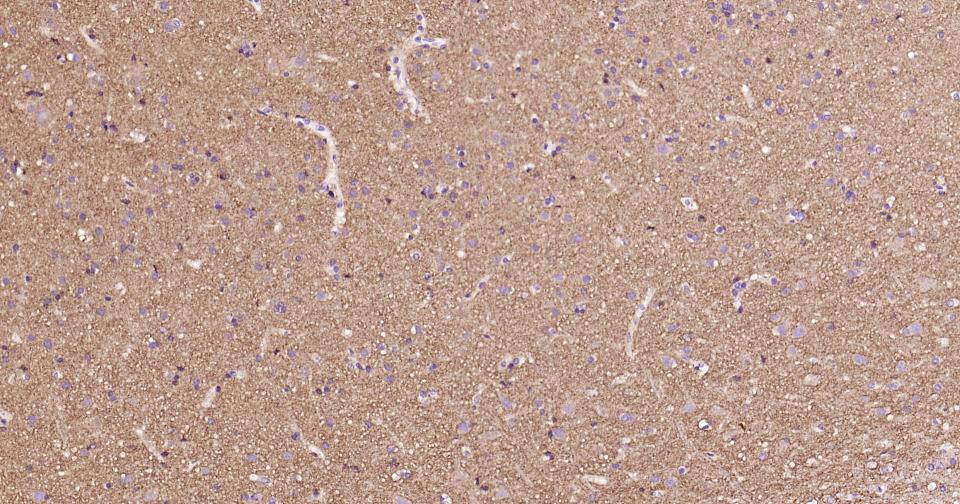 Alpha-Synuclein Mouse mAb(bsm-