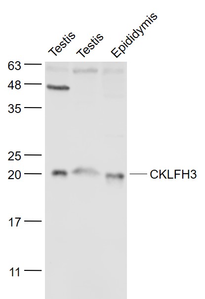 CKLFH3 Rabbit pAb(bs-8021R)-50