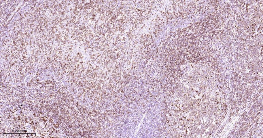 CD79a Mouse mAb(bsm-33449M)-50