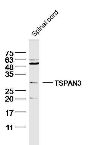TSPAN3 Rabbit pAb(bs-9412R)-50
