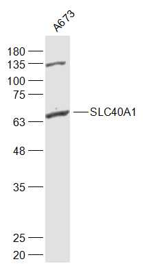 SLC40A1 Rabbit pAb(bs-4906R)-5