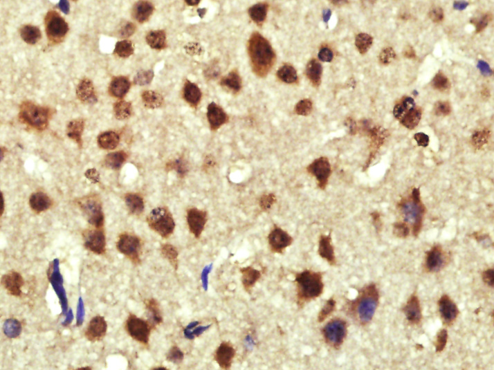 Cyclin D1 Rabbit pAb(bs-20596R