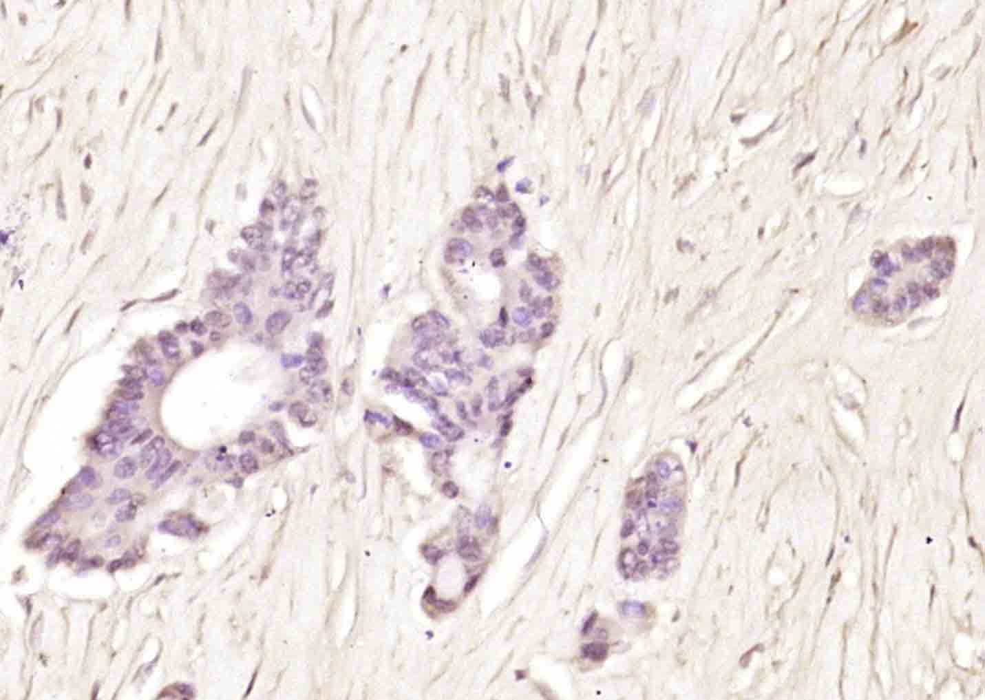 DNTNP Rabbit pAb(bs-11839R)-50