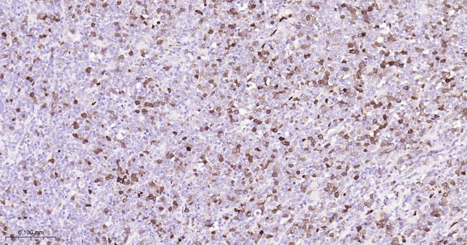 TYMS Recombinant Rabbit mAb(bs