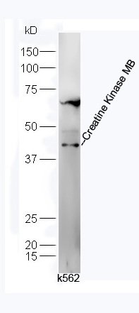 Creatine Kinase MB Rabbit pAb(