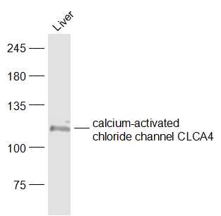calcium-activated chloride cha