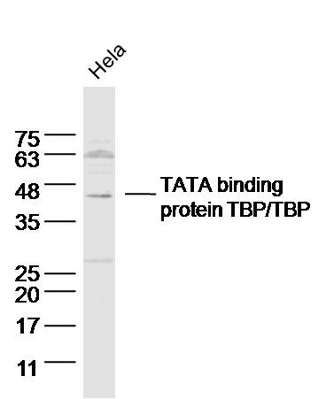 TBP Rabbit pAb(bs-11766R)-50ul