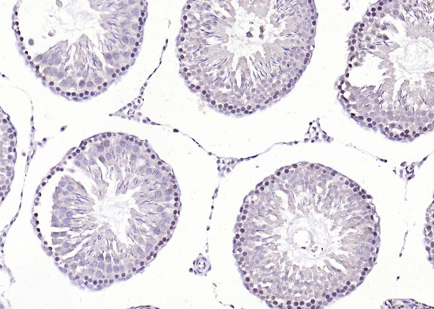 CREM Rabbit pAb(bs-5135R)-50ul