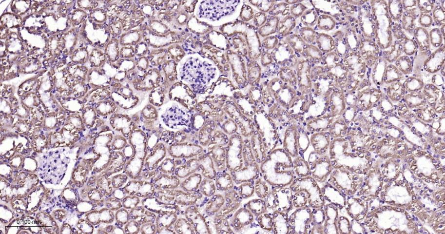 VDAC1 Recombinant Rabbit mAb, 