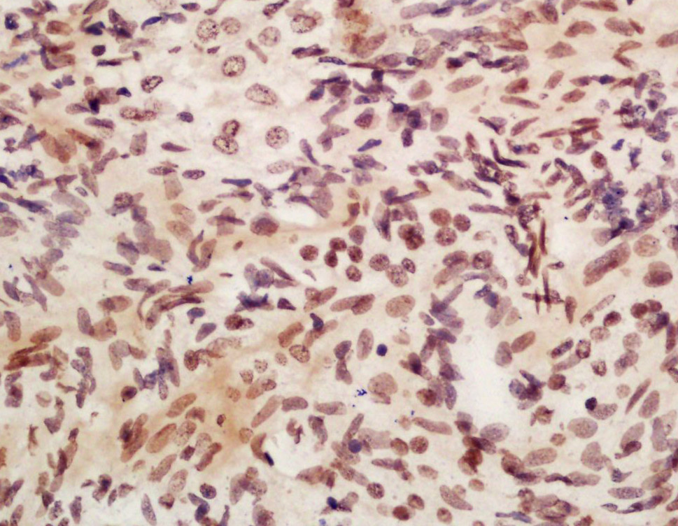 APOBEC3B Rabbit pAb(bs-12494R)