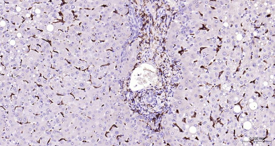 CD163 Rabbit pAb(bs-2527R)-50u