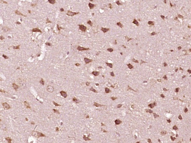 phospho-Stat2 (Tyr690) Rabbit 